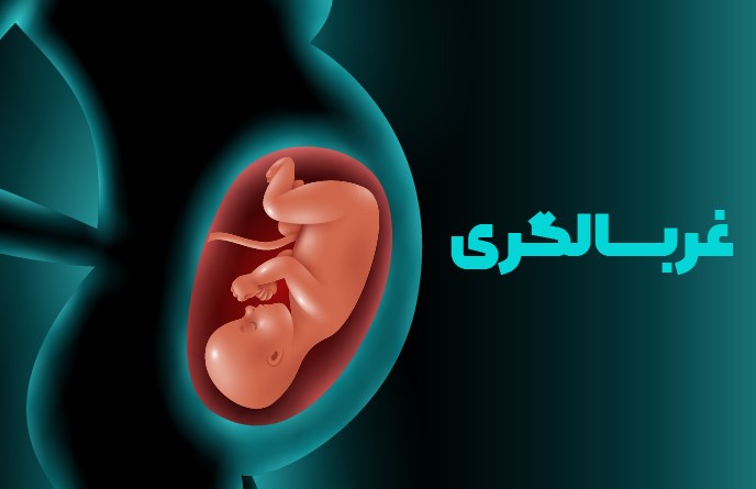 اپیدمیولوژی بالینی غربالگری